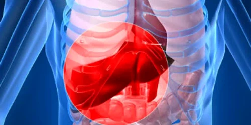 Ecografia abdominala pentru diagnosticul incarcarii grase a ficatului