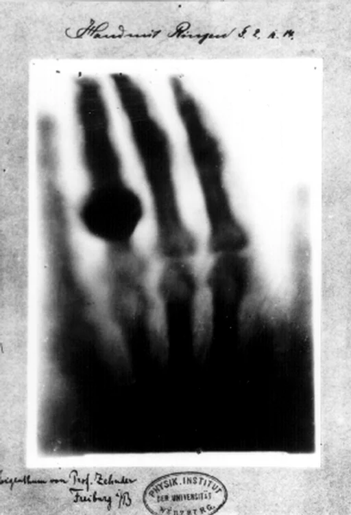 radiografie jpg jpeg
