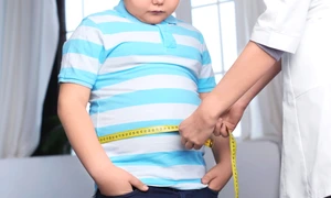 Copil gras supraponderal FOTO Shutterstock jpg