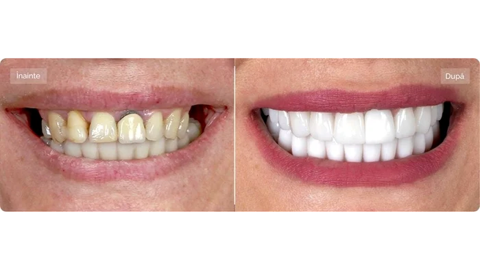 Rescris art4 presa dent park povestea Cristinei final  16x9 png