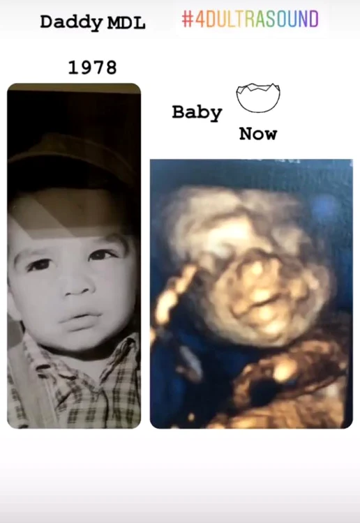 
    Catrinel Menghia a publicat și câteva ecografii cu bebelușul Foto Instagram  