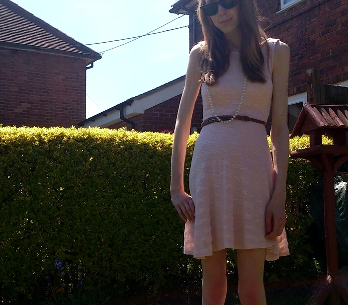 
    Sarah Leanne Pustkowski ajunsese să cântărească numai 36 de kilogramefoto: Photoland Caters  