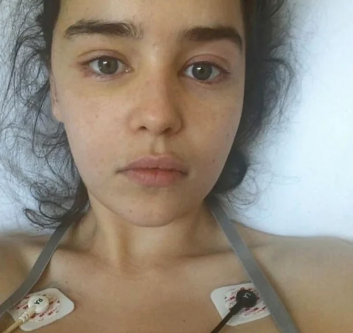 
    Emilia Clarke a suferit două anevrisme cerebrale în urmă cu mai mulți aniFoto: Arhiva personală  