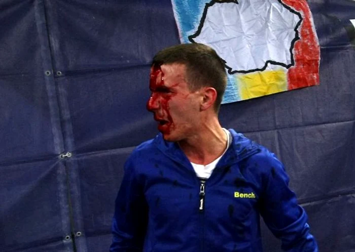 
    Un fan a fost umplut de sange la meciul Romania - UngariaFoto: Mediafax  