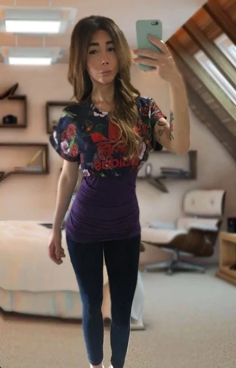 Daniela recunoaște că e dependentă de acid hialuronic și botox