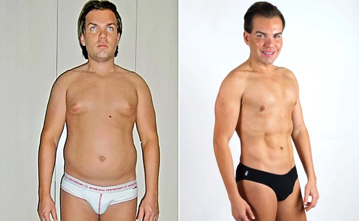 
    Rodrigo,  un tânăr  normal,  în 2001 (foto stânga). Rodrigo, în 2015, un om de plastic (foto dreapta)  
