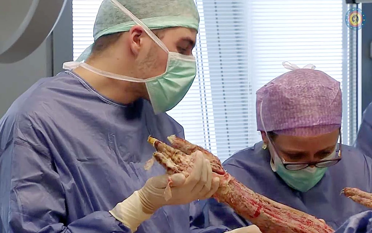 Suprafeţele roz  reprezintă tendoanele  care au putut fi salvate