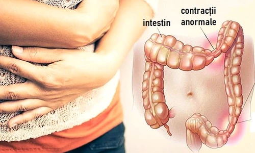 Simptome colon iritabil jpeg