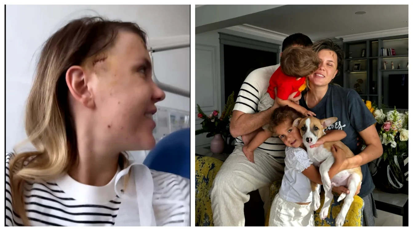 Emily Burghelea a început să facă terapie la psiholog, după accident