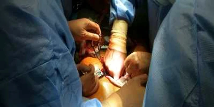 Medicii mureşeni au efectuat anul acesta patru transplanturi de cord foto Arhivă