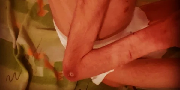 calarasi copil cu dizabilitati hranit necorespunzator FOTO news.ro