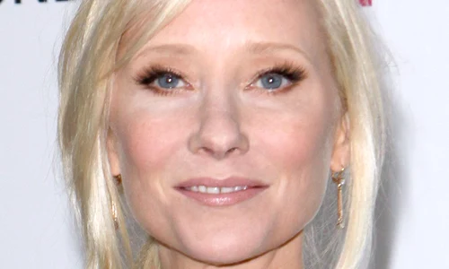 Anne Heche în moarte cerebrală jpg