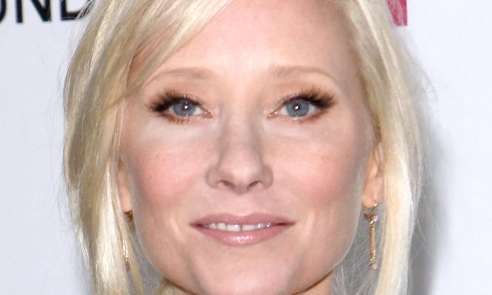 Anne Heche în moarte cerebrală jpg