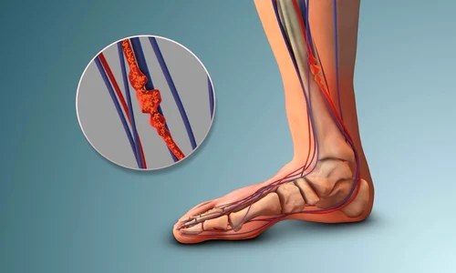 shutterstock 2609239625 jpg