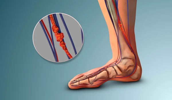 shutterstock 2609239625 jpg