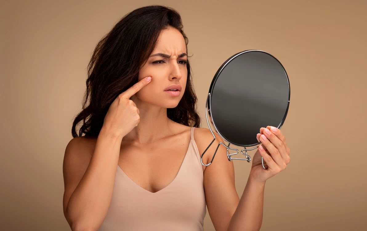 Pielea neîngrijită poate fi un semn clar al dezechilibrului nostru interior FOTO Shutterstock