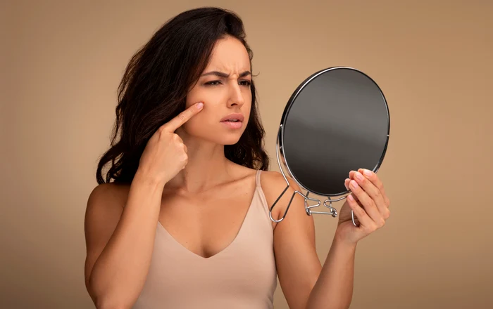 Pielea neîngrijită poate fi un semn clar al dezechilibrului nostru interior FOTO Shutterstock