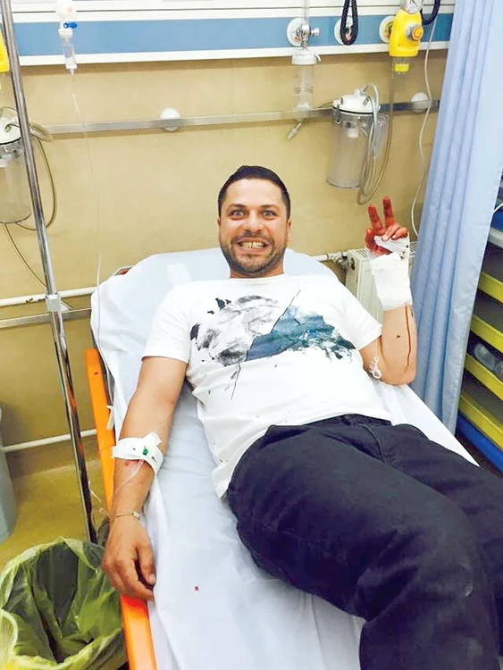 Așa arăta mâna lui Augustin după accidentul suferit în finala emisiunii ”Ferma Vedetelor” de la Pro tv