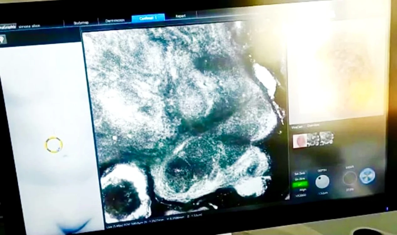 Aparat unic în ţară, la Spitalul de Boli Infecţioase Galaţi, sursa: CJG