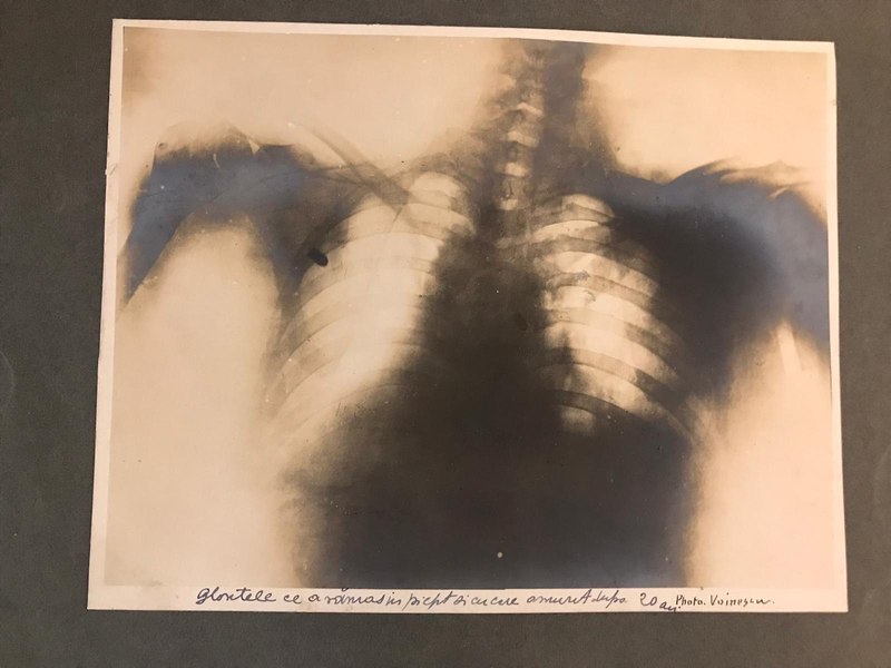 Radiografia făcută lui Ion I.C. Brătianu după un atentat, declarată obiect de tezaur național