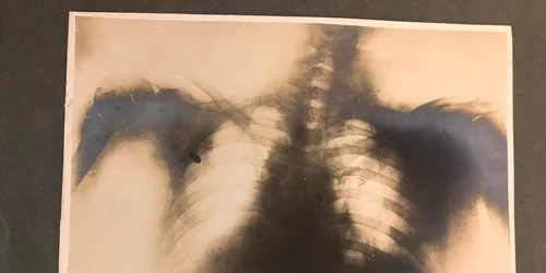 radiografie glonte ionel bratianu foto muzeul bratianu jpg