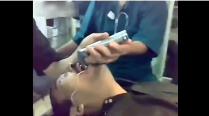 Bărbatul din imagine a înghiţit o cheie metalicăFoto 220