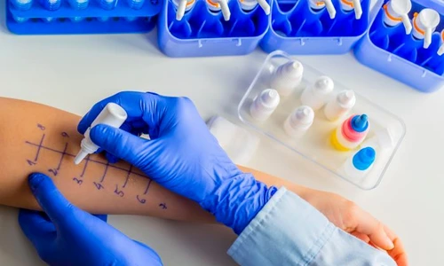 1 test alergii jpg jpeg