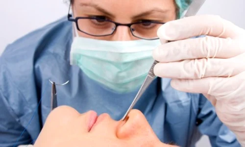 how rhinoplasty works for men jpeg