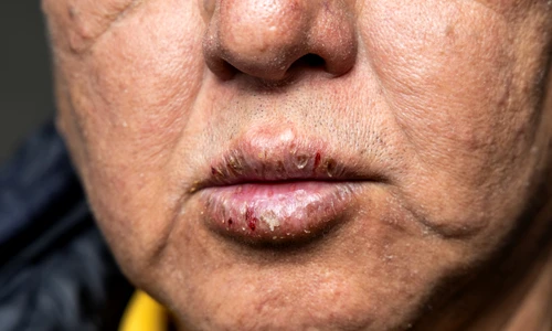 shutterstock 2496000669 jpg