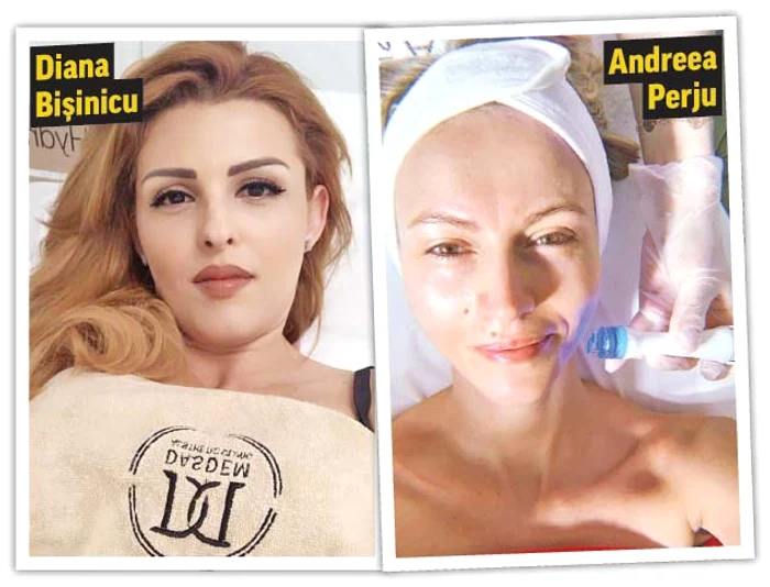 Vica Blochina caută să scape de ridurile de pe faţă şi gât