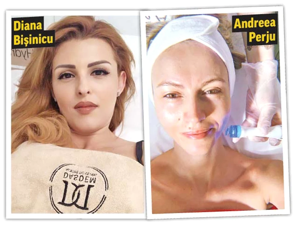 
    Vica Blochina caută să scape  de ridurile de  pe faţă şi gât  
