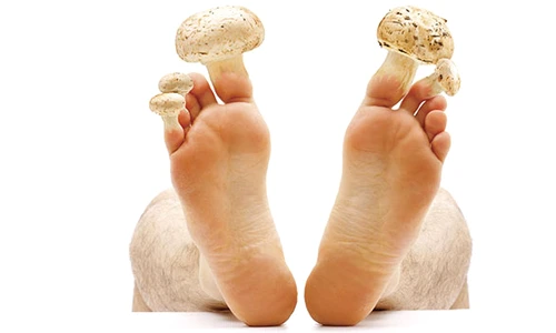 Ciuperca piciorului simptome şi tratament jpeg