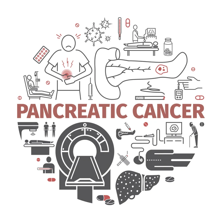 Cancer pancreatic