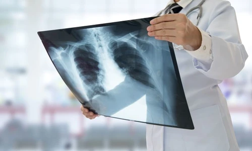 1 shutterstock 548009926 jpg jpeg