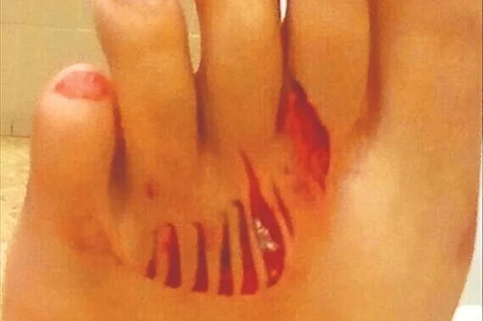 Fata a fost dusă de urgență la spital