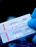 HIV  shutterstock 2471456149 jpg