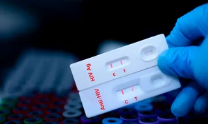 HIV  shutterstock 2471456149 jpg