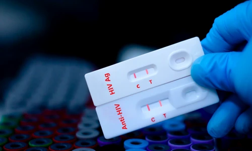 HIV  shutterstock 2471456149 jpg