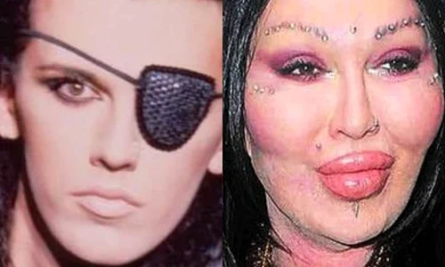 1 pete burns deschidere jpg jpeg