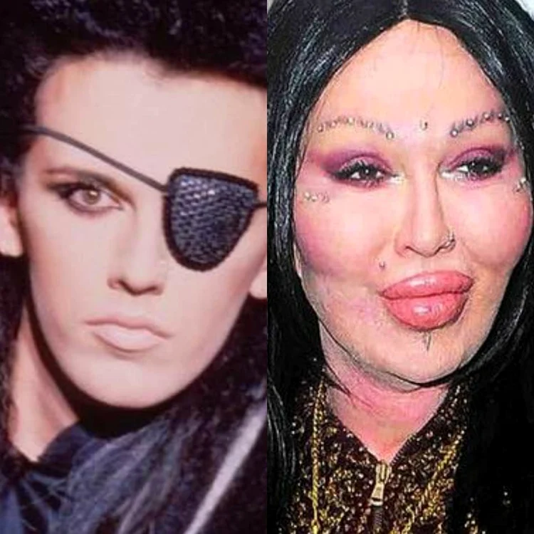 1 pete burns deschidere jpg jpeg