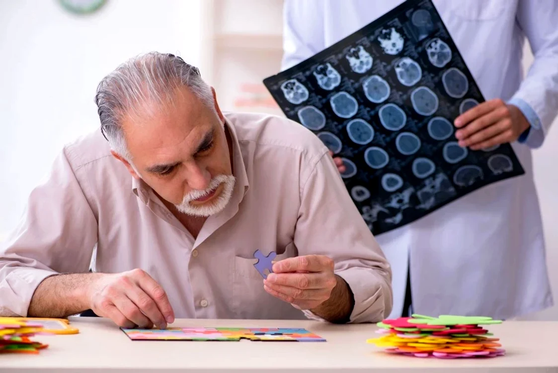 boala Alzheimer jpg
