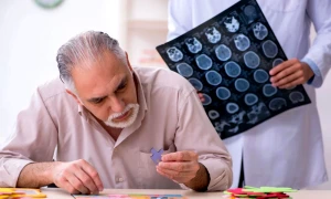 boala Alzheimer jpg