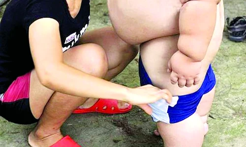 Băiatul e aşa de gras, că are  nevoie să fie îmbrăcat de mama sa jpeg