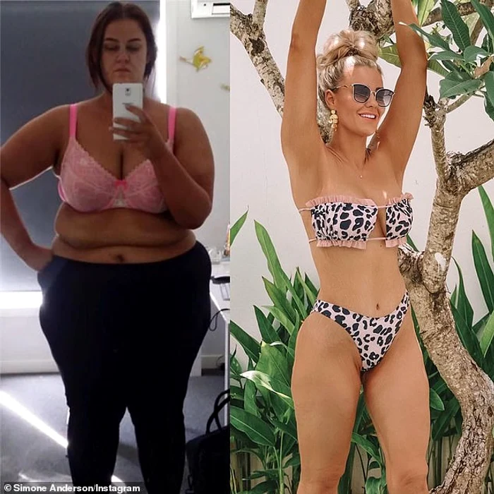 2014: Cântărea 169 de kilograme. 2020: A slăbit 92 de kilograme şi a plătit 20.000 $ să-şi facă un trup de invidiat