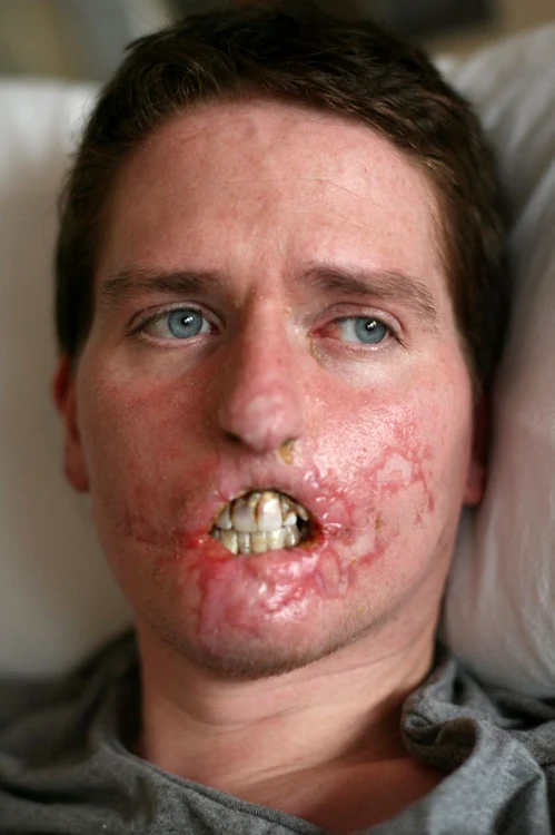 Alex Lewis (foto: Rexfeatures)