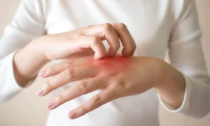 dermatita main jpg