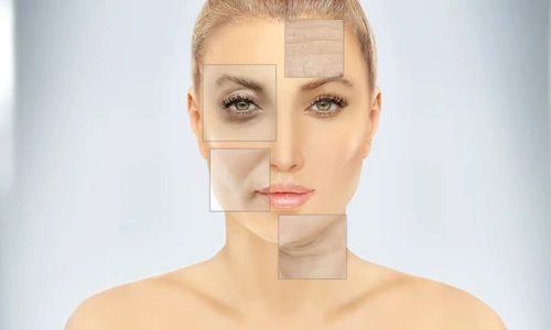 Semnele imbatranirii premature  Sursa foto shutterstock 2470926875 jpg