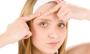 sfaturi pentru un ten perfect fara cosuri jpeg