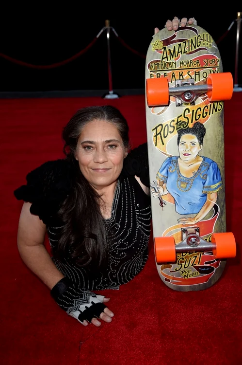 Rose Siggins suferea de o afecțiune gravă