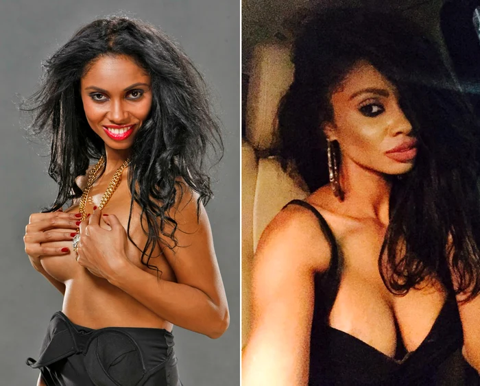 Laurette se va supune unei noi intervenţii